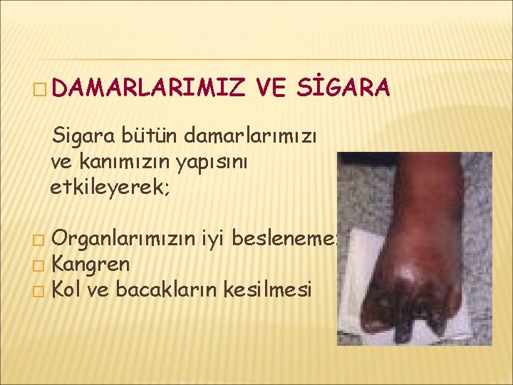 � DAMARLARIMIZ VE SİGARA Sigara bütün damarlarımızı ve kanımızın yapısını etkileyerek; � Organlarımızın �