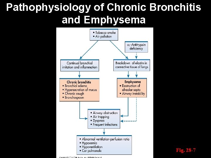 Pathophysiology of Chronic Bronchitis and Emphysema Fig. 28 -7 