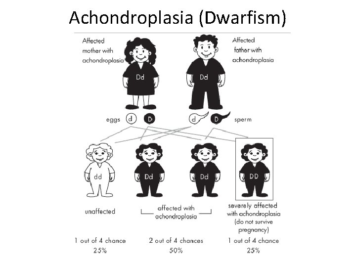 Achondroplasia (Dwarfism) 