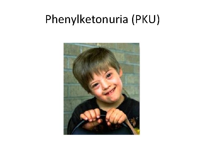 Phenylketonuria (PKU) 