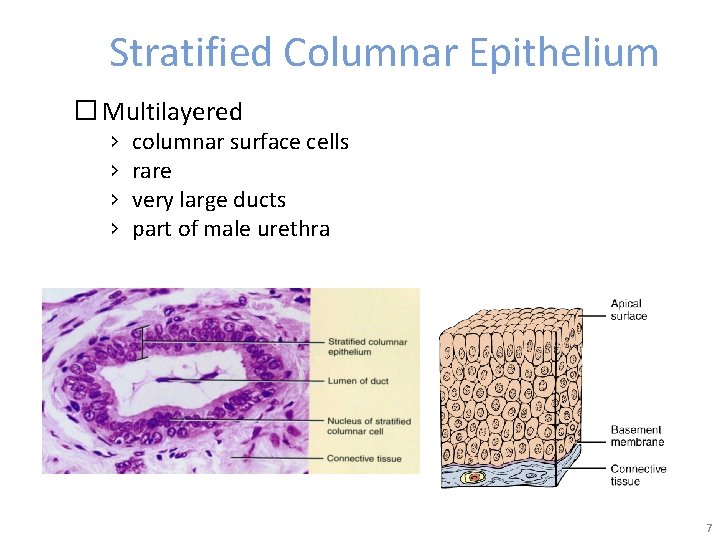 Stratified Columnar Epithelium � Multilayered › › columnar surface cells rare very large ducts
