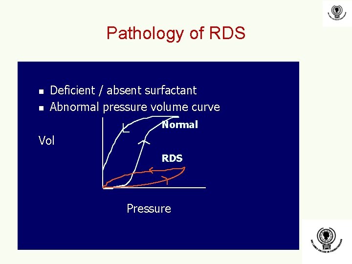 Pathology of RDS n n Deficient / absent surfactant Abnormal pressure volume curve Normal