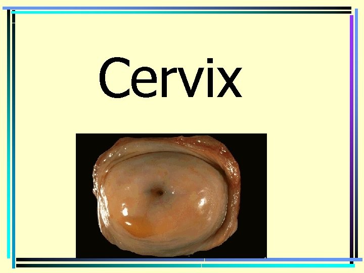 Cervix 