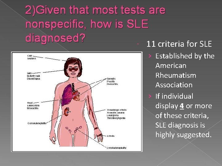 2)Given that most tests are nonspecific, how is SLE diagnosed? 11 criteria for SLE