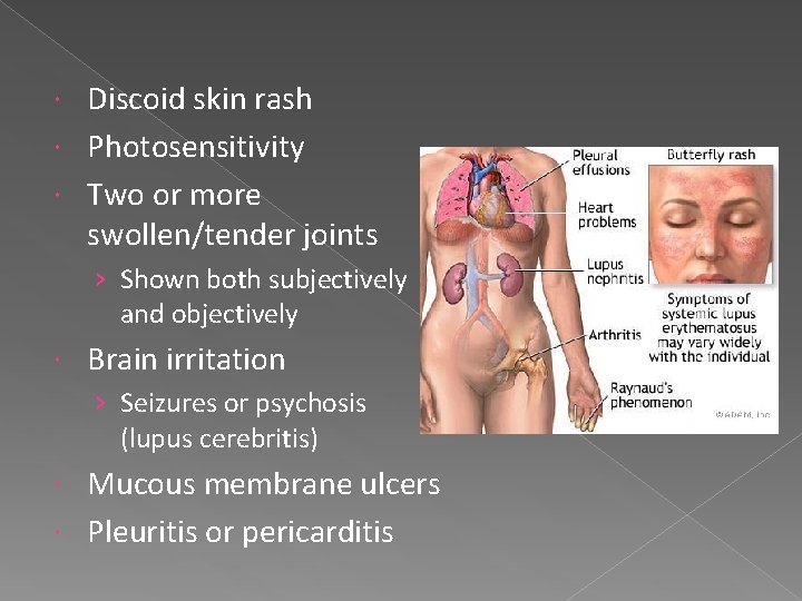 Discoid skin rash Photosensitivity Two or more swollen/tender joints › Shown both subjectively and
