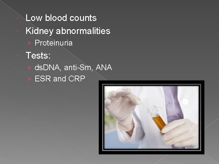 Low blood counts Kidney abnormalities › Proteinuria Tests: › ds. DNA, anti-Sm, ANA ›