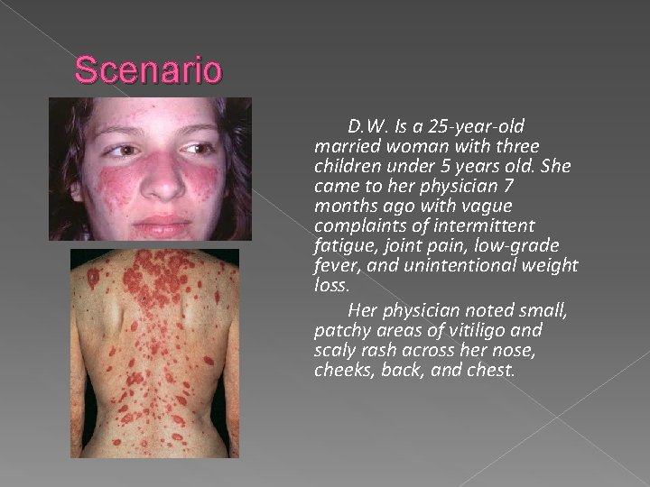 Scenario D. W. Is a 25 -year-old married woman with three children under 5