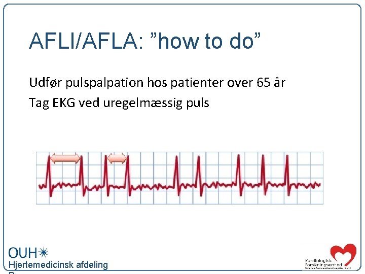 AFLI/AFLA: ”how to do” Udfør pulspalpation hos patienter over 65 år Tag EKG ved