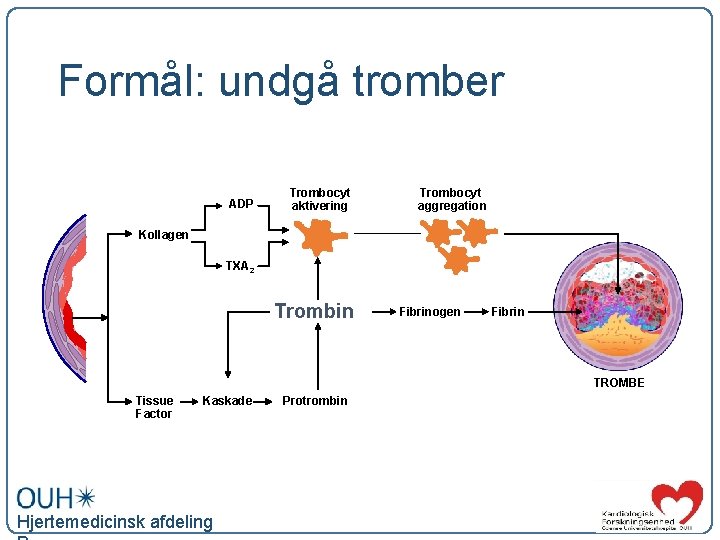 Formål: undgå tromber ADP Trombocyt aktivering Trombocyt aggregation Kollagen TXA 2 Trombin Fibrinogen Fibrin