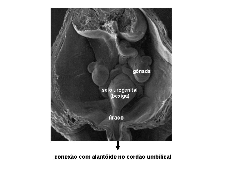 gônada seio urogenital (bexiga) úraco conexão com alantóide no cordão umbilical 
