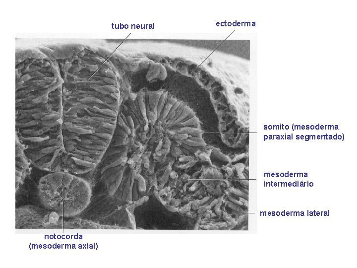 tubo neural ectoderma somito (mesoderma paraxial segmentado) mesoderma intermediário mesoderma lateral notocorda (mesoderma axial)