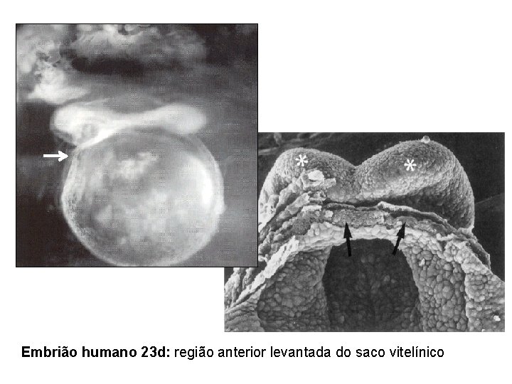 Embrião humano 23 d: região anterior levantada do saco vitelínico 