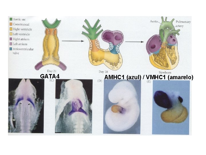 GATA 4 AMHC 1 (azul) / VMHC 1 (amarelo) 