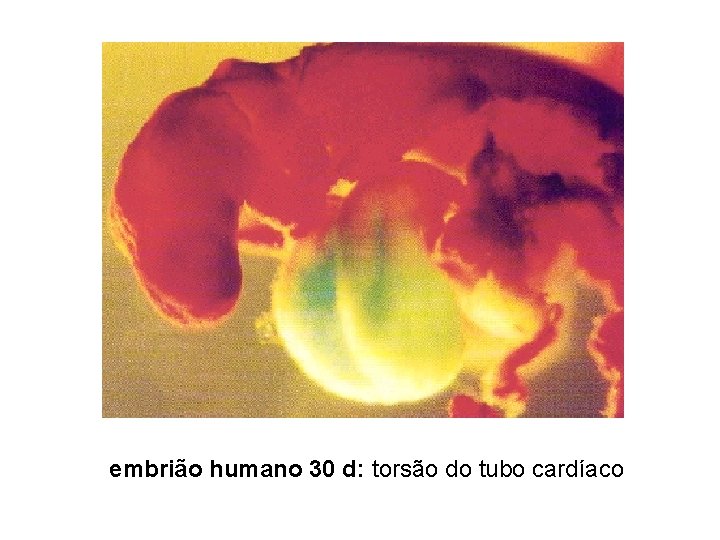 embrião humano 30 d: torsão do tubo cardíaco 