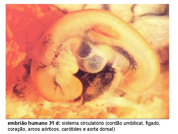 embrião humano 31 d: sistema circulatório (cordão umbilical, figado, coração, arcos aórticos, carótides e