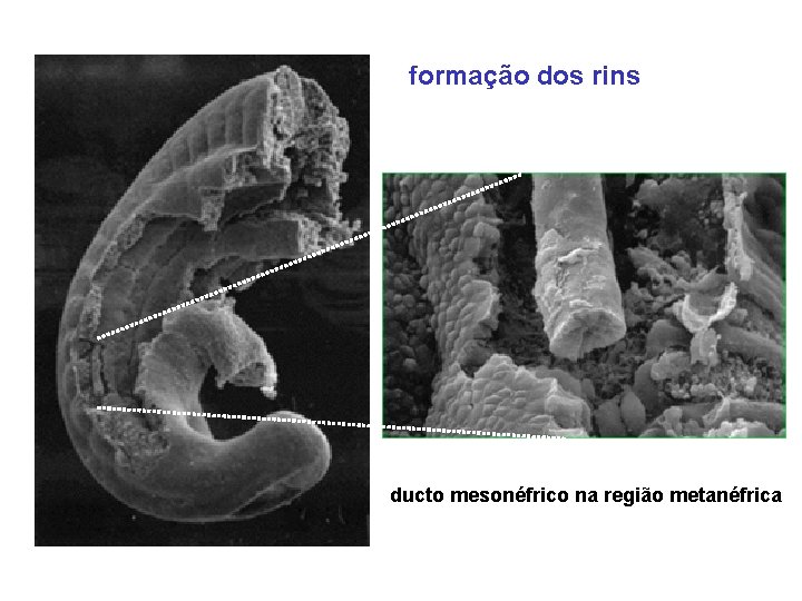 formação dos rins ducto mesonéfrico na região metanéfrica 