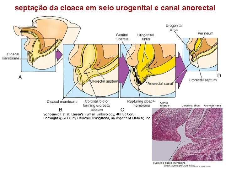 septação da cloaca em seio urogenital e canal anorectal 