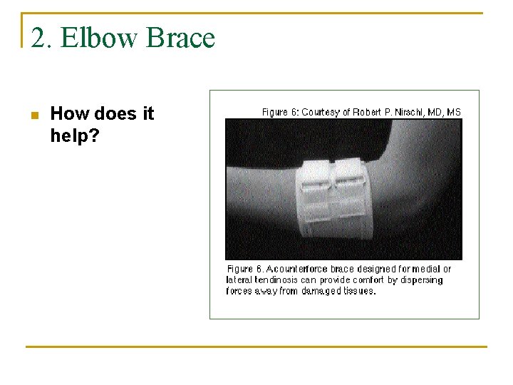 2. Elbow Brace n How does it help? 