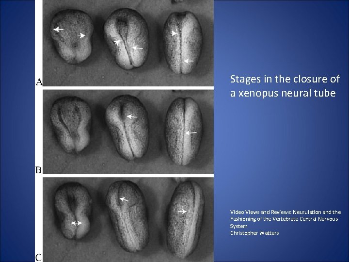 Stages in the closure of a xenopus neural tube Video Views and Reviews: Neurulation