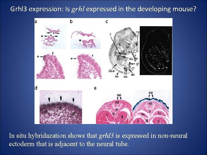 Grhl 3 expression: Is grhl expressed in the developing mouse? In situ hybridazation shows