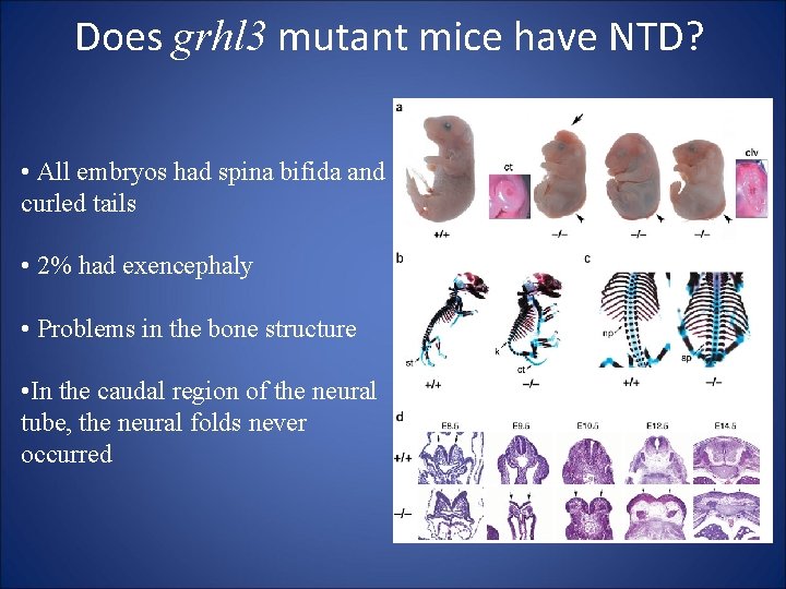 Does grhl 3 mutant mice have NTD? • All embryos had spina bifida and