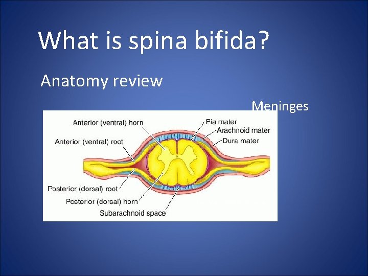 What is spina bifida? Anatomy review Meninges Dorland’s Medical Dictionary 