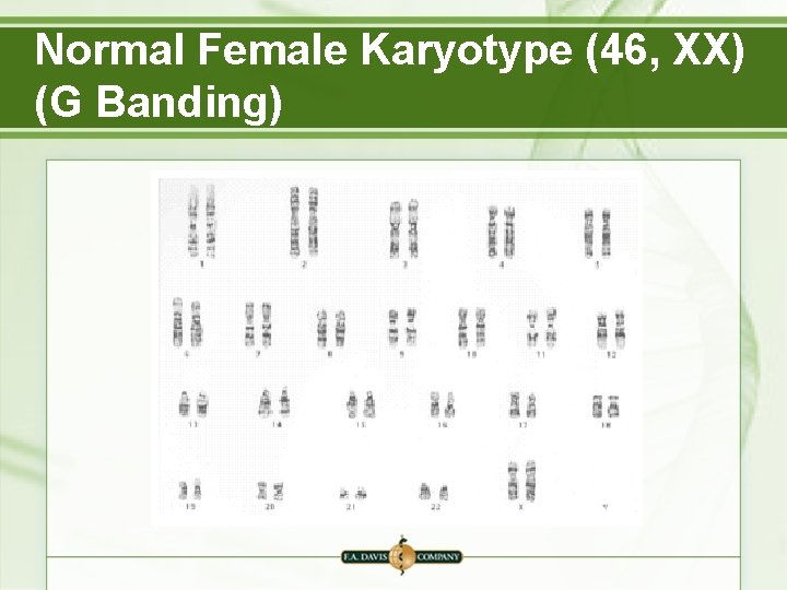 Normal Female Karyotype (46, XX) (G Banding) 