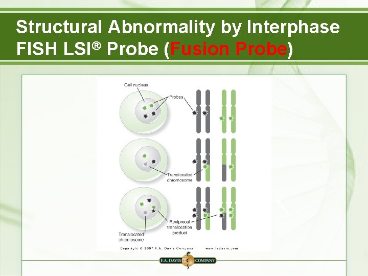 Structural Abnormality by Interphase FISH LSI Probe (Fusion Probe) 