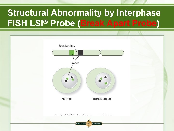 Structural Abnormality by Interphase FISH LSI Probe (Break Apart Probe) 