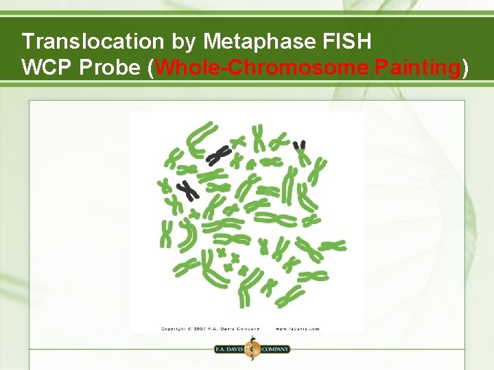 Translocation by Metaphase FISH WCP Probe (Whole-Chromosome Painting) 