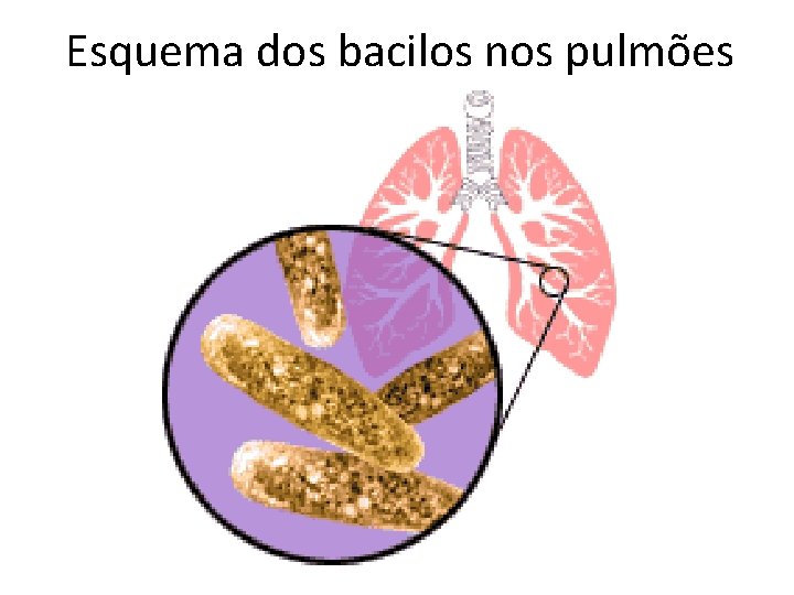 Esquema dos bacilos nos pulmões 