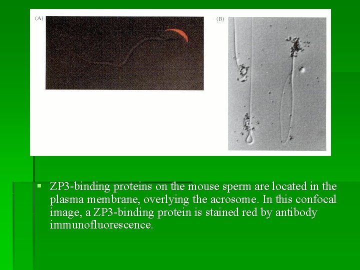 § ZP 3 -binding proteins on the mouse sperm are located in the plasma