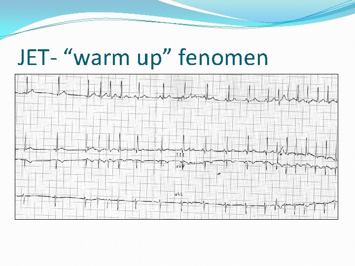 JET- “warm up” fenomen 