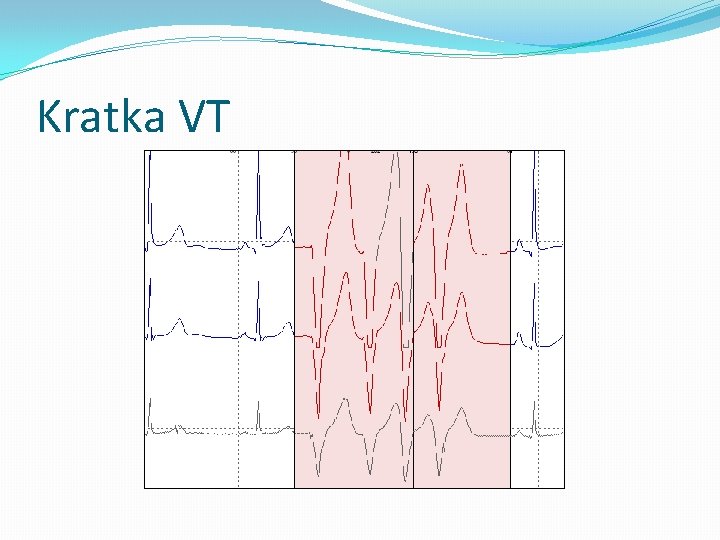 Kratka VT 