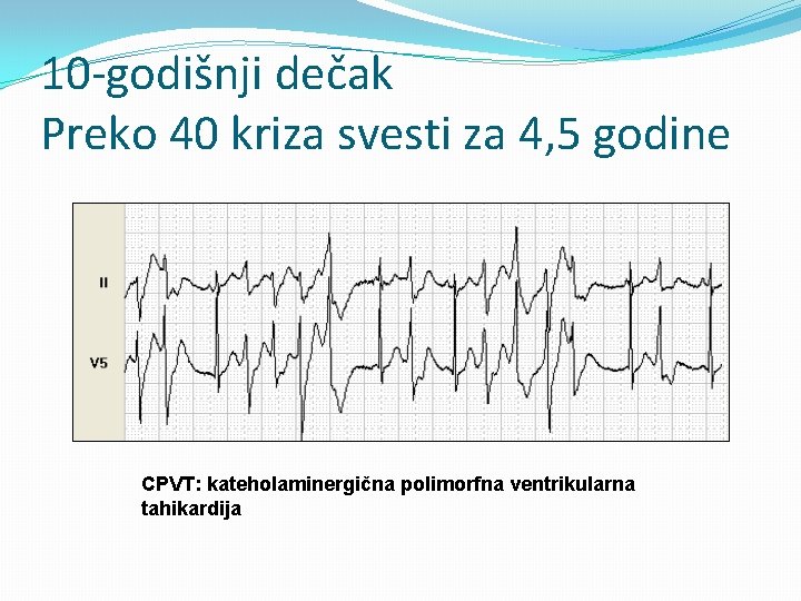 10 -godišnji dečak Preko 40 kriza svesti za 4, 5 godine CPVT: kateholaminergična polimorfna