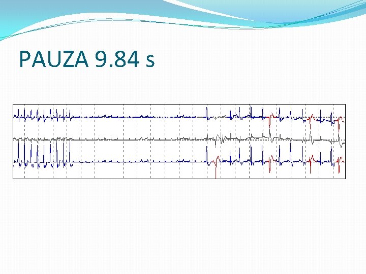 PAUZA 9. 84 s 