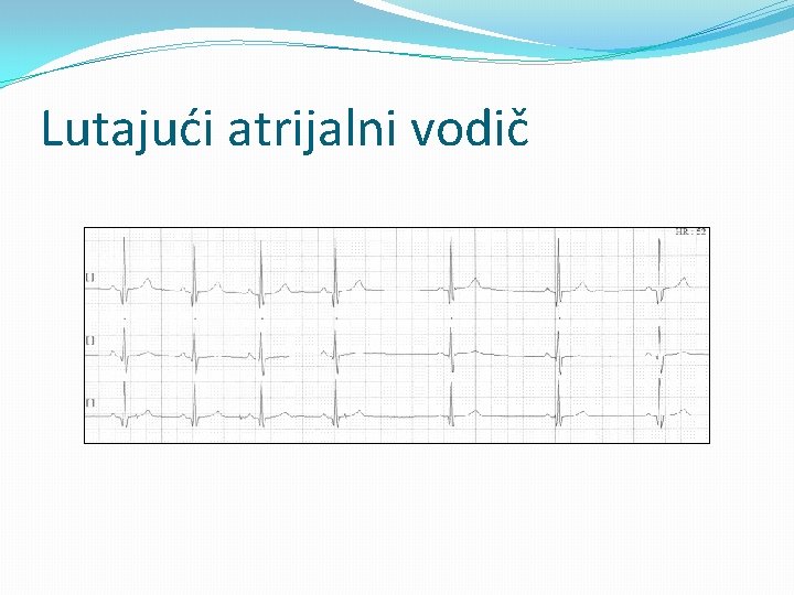 Lutajući atrijalni vodič 