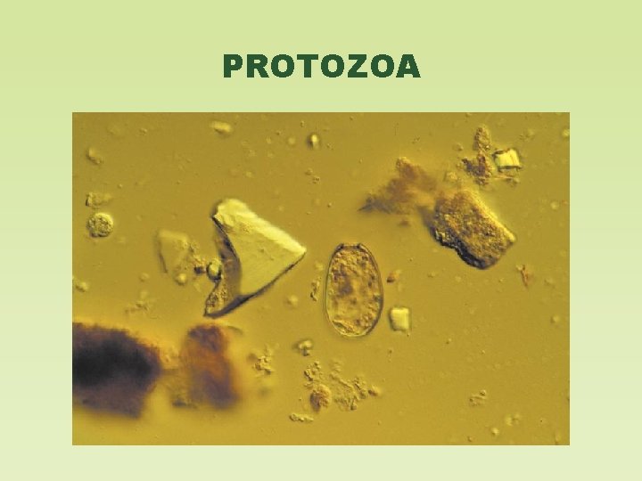 PROTOZOA 