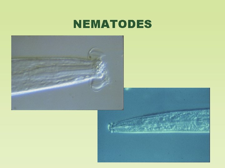 NEMATODES 