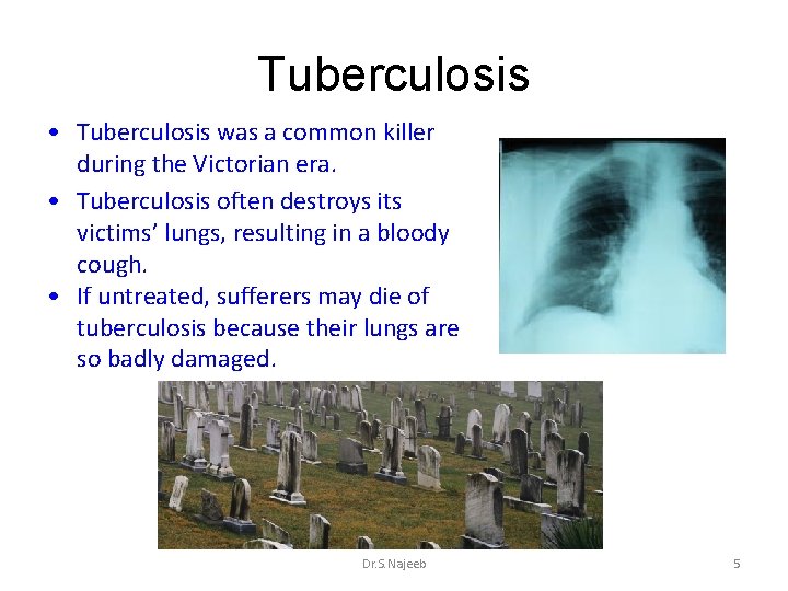 Tuberculosis • Tuberculosis was a common killer during the Victorian era. • Tuberculosis often