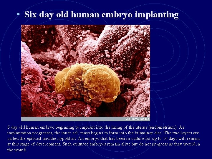  • Six day old human embryo implanting 6 day old human embryo beginning