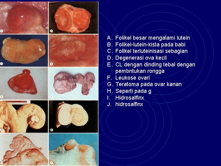 A. B. C. D. E. F. G. H. I. J. Folikel besar mengalami lutein