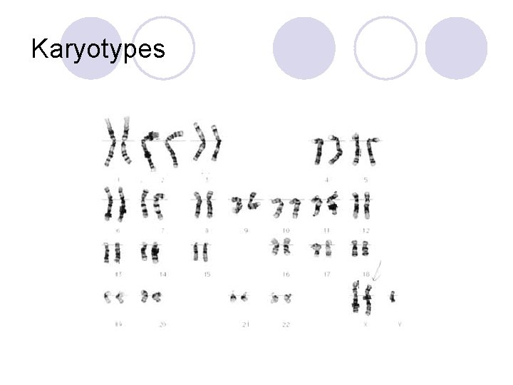 Karyotypes 