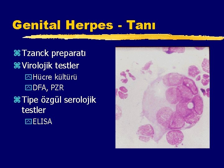 Genital Herpes - Tanı z Tzanck preparatı z Virolojik testler y. Hücre kültürü y.