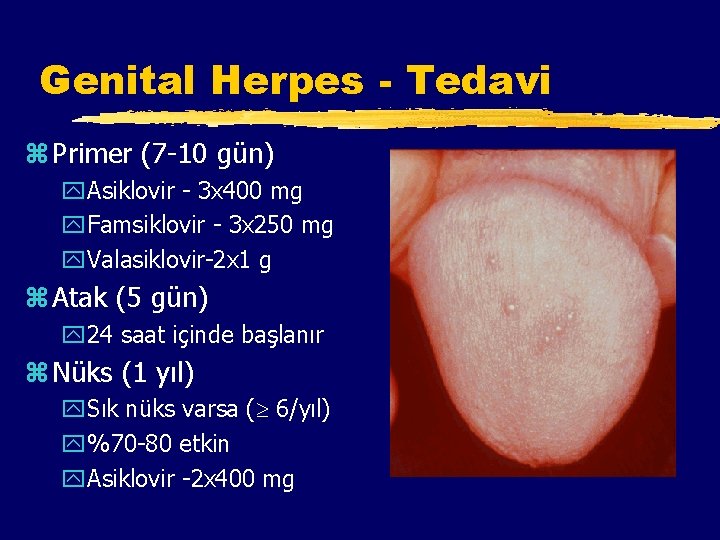 Genital Herpes - Tedavi z Primer (7 -10 gün) y. Asiklovir - 3 x