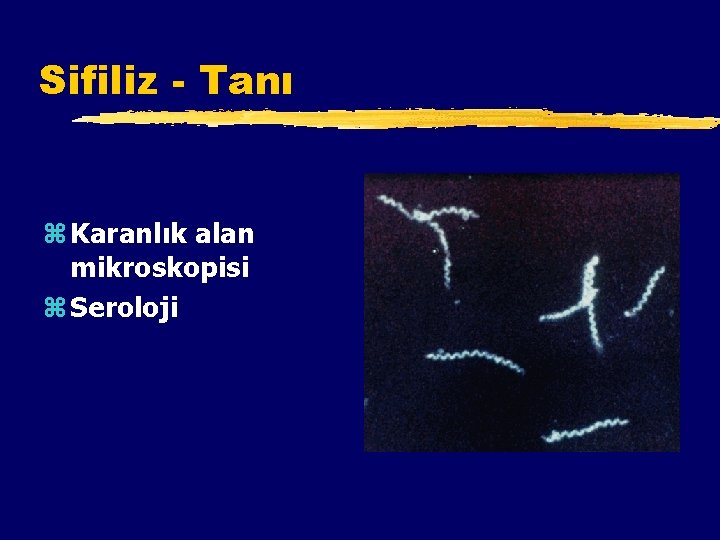 Sifiliz - Tanı z Karanlık alan mikroskopisi z Seroloji 