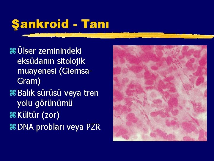 Şankroid - Tanı z Ülser zeminindeki eksüdanın sitolojik muayenesi (Giemsa. Gram) z Balık sürüsü