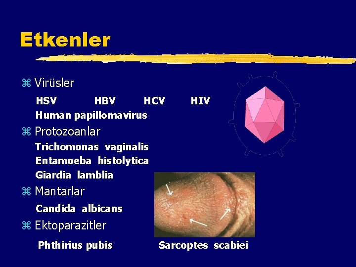 Etkenler z Virüsler HSV HBV HCV Human papillomavirus HIV z Protozoanlar Trichomonas vaginalis Entamoeba