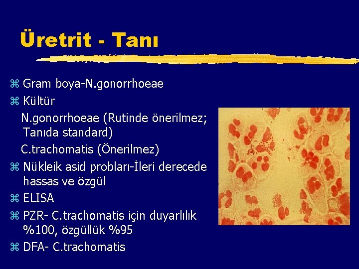 Üretrit - Tanı z Gram boya-N. gonorrhoeae z Kültür N. gonorrhoeae (Rutinde önerilmez; Tanıda