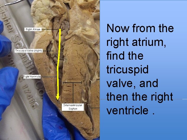 Now from the right atrium, find the tricuspid valve, and then the right ventricle.